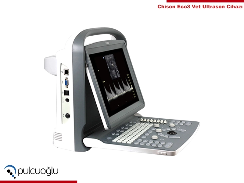 Chison ECO3 Ultrason Cihazı